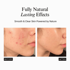 Bakuchiol Glass Skin Elixir