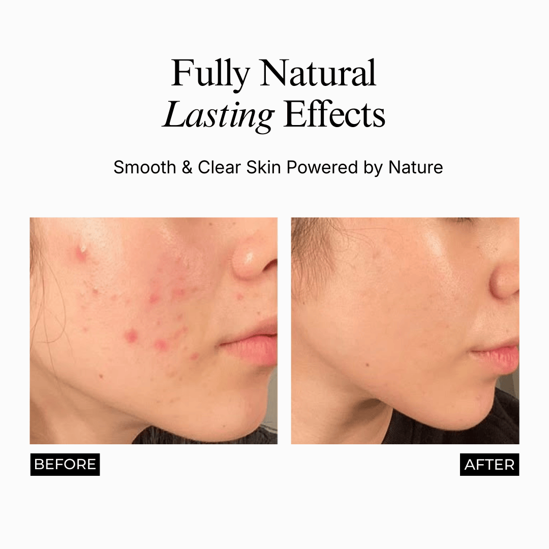 Bakuchiol Glass Skin Elixir